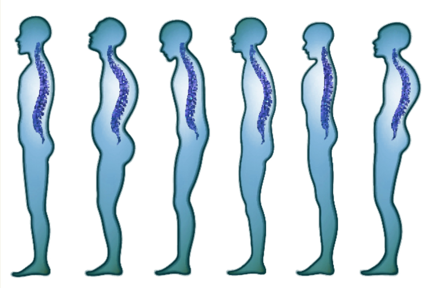 Different posture types
